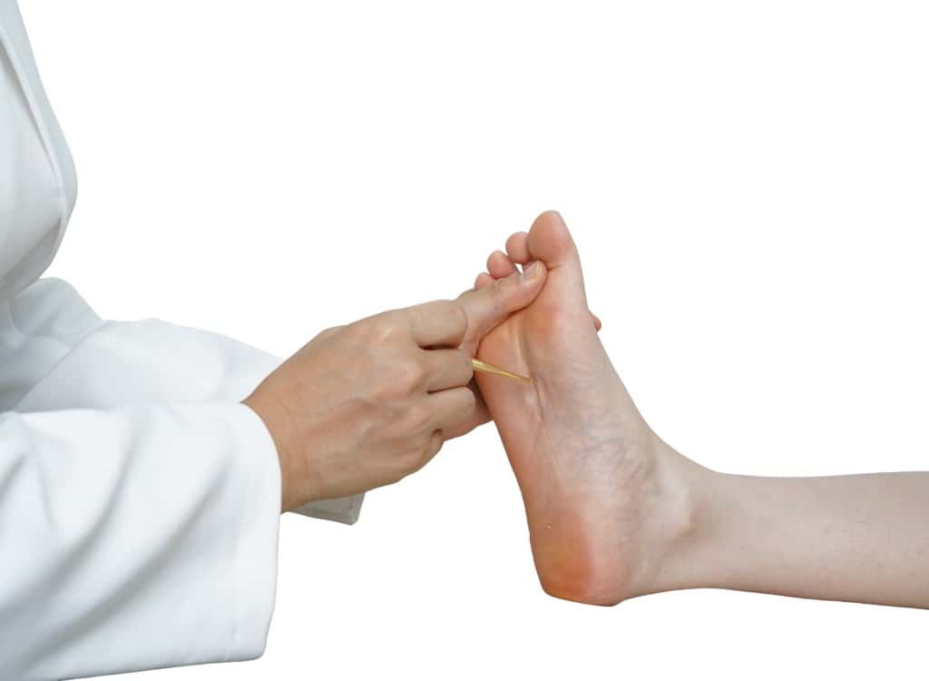 A clinician testing the sole of a foot with a pointed instrument