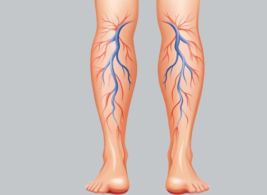 Illustration of arteries and veins running through both lower legs